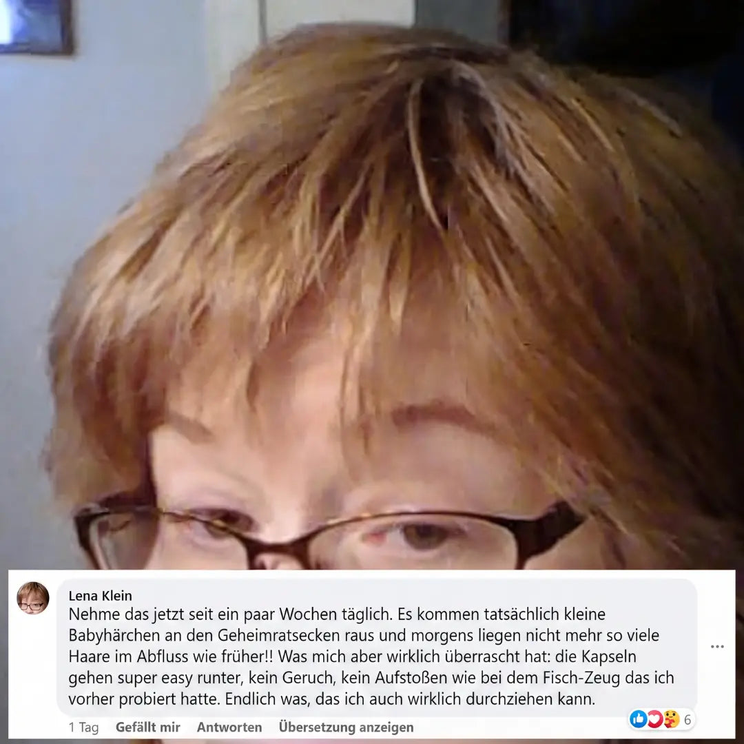 Phyrow® Kürbiskernöl & Sägepalme Kapseln für maximale Haardichte