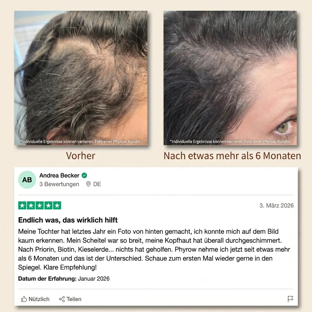 Phyrow® Kürbiskernöl & Sägepalme Kapseln für maximale Haardichte