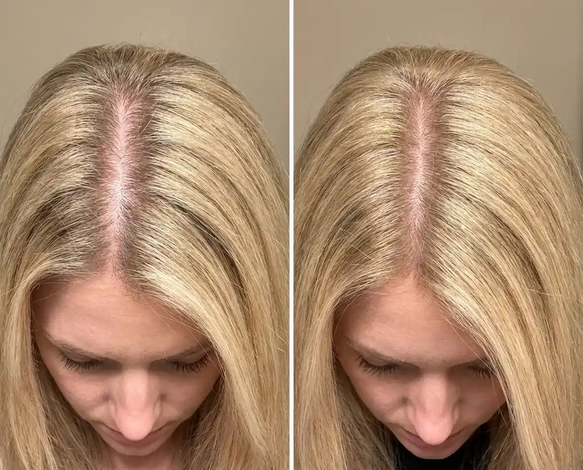 kurbiskernol_haare_vorher_nachher_ergebnisse-phyrow