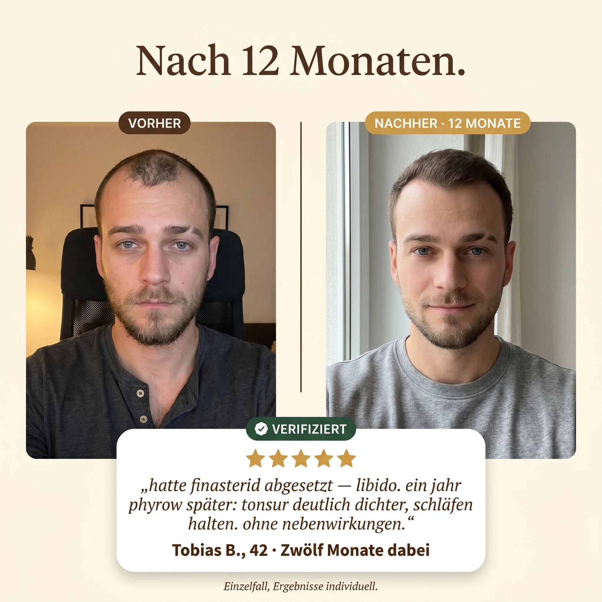 Vorher Nachher nach 12 Monaten, Tobias B. 42 Jahre, mit Testimonial-Karte und fünf Sternen. Quote bezieht sich auf das Absetzen von Finasterid wegen Libido-Nebenwirkungen.
