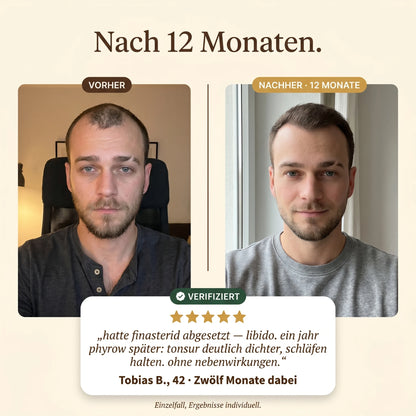 Vorher Nachher nach 12 Monaten, Tobias B. 42 Jahre, mit Testimonial-Karte und fünf Sternen. Quote bezieht sich auf das Absetzen von Finasterid wegen Libido-Nebenwirkungen.