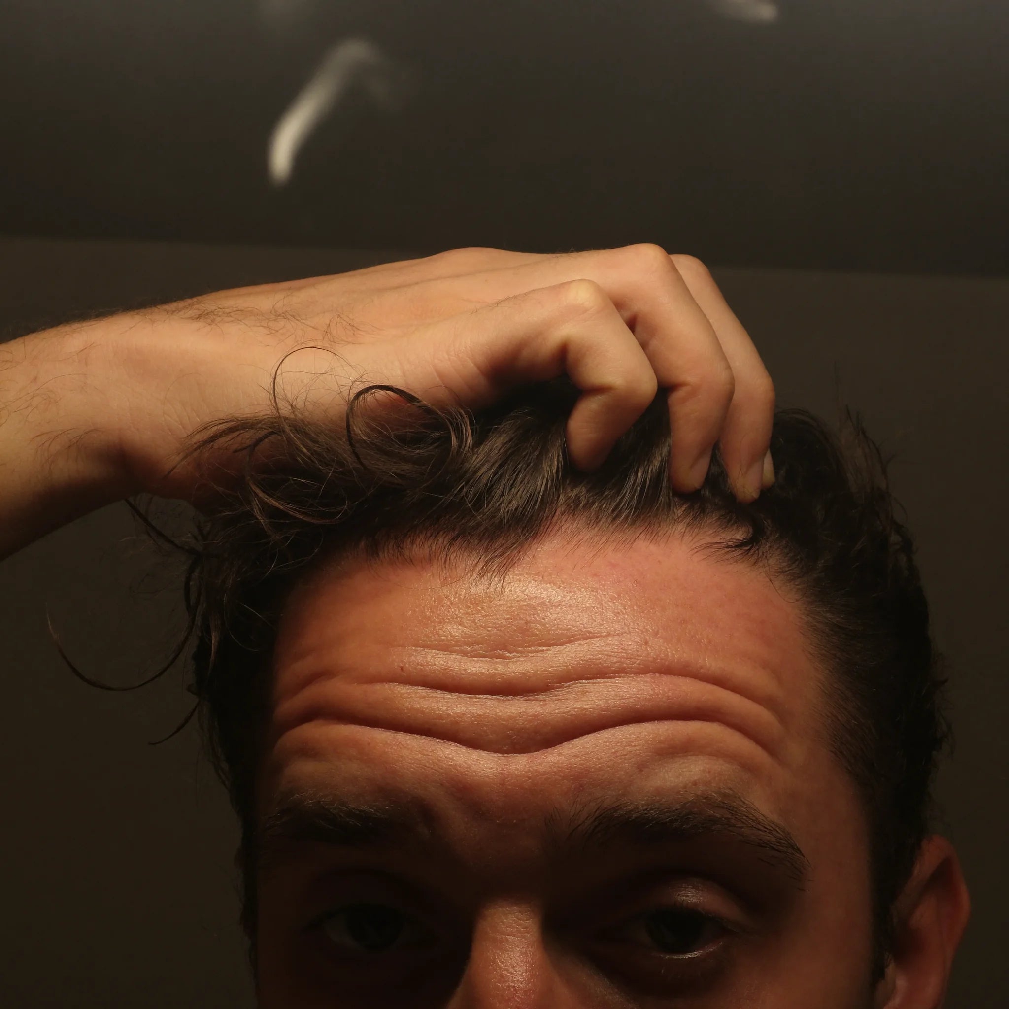 Hand hebt Haare am Haaransatz, Kopfhaut im Anschnitt sichtbar.